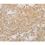 Immunohistochemistry - VTN Antibody from Signalway Antibody (36196) - Antibodies.com