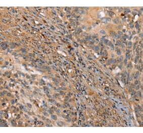 Immunohistochemistry - HK3 Antibody from Signalway Antibody (36212) - Antibodies.com