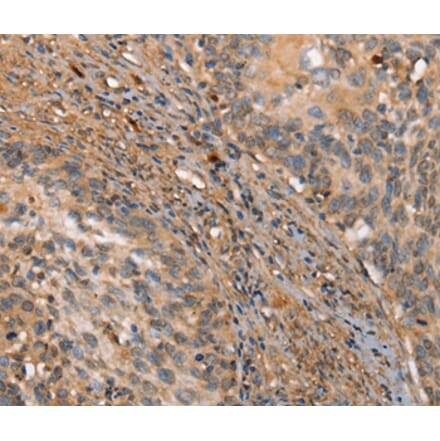 Immunohistochemistry - HK3 Antibody from Signalway Antibody (36212) - Antibodies.com