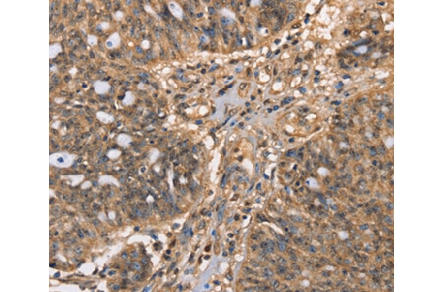 Immunohistochemistry - HK3 Antibody from Signalway Antibody (36212) - Antibodies.com
