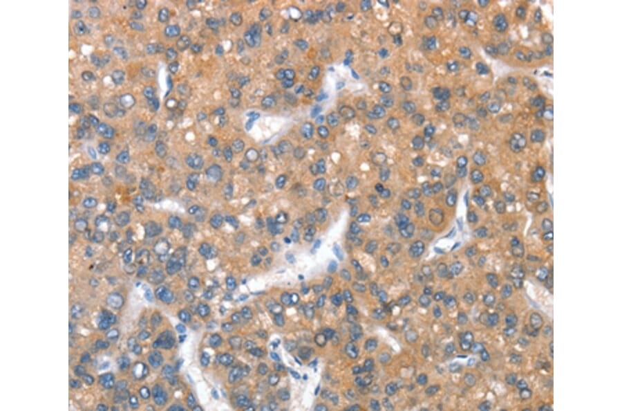 Immunohistochemistry - KEL Antibody from Signalway Antibody (36286) - Antibodies.com