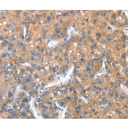 Immunohistochemistry - KEL Antibody from Signalway Antibody (36286) - Antibodies.com