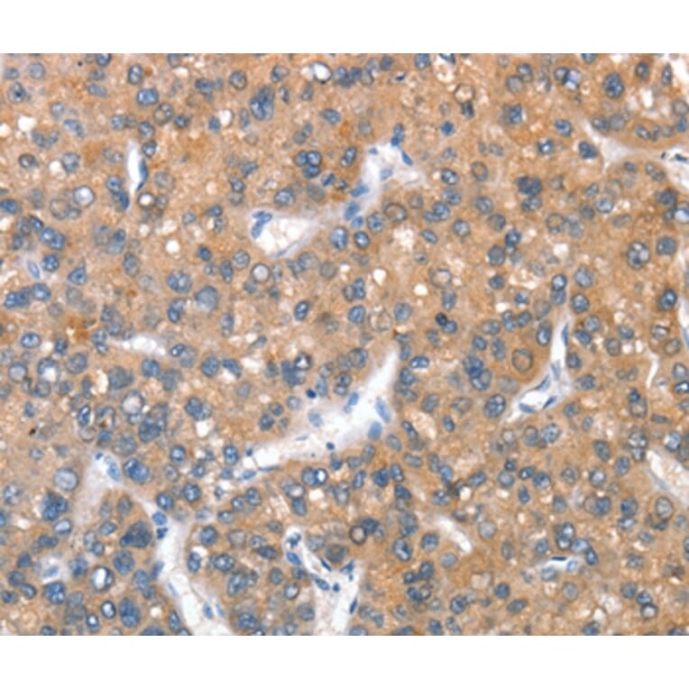 Immunohistochemistry - KEL Antibody from Signalway Antibody (36286) - Antibodies.com