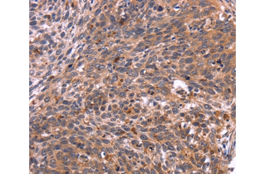 Immunohistochemistry - CRK Antibody from Signalway Antibody (36372) - Antibodies.com