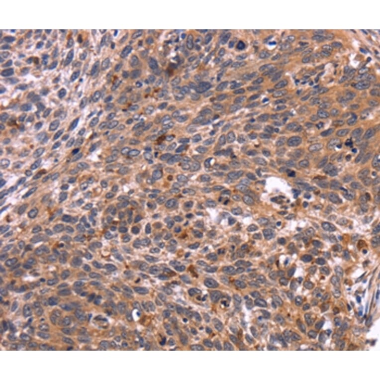 Immunohistochemistry - CRK Antibody from Signalway Antibody (36372) - Antibodies.com