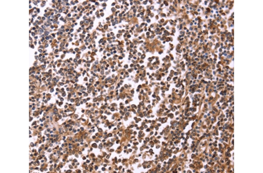 Immunohistochemistry - CRK Antibody from Signalway Antibody (36372) - Antibodies.com