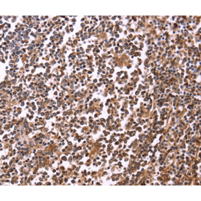 Immunohistochemistry - CRK Antibody from Signalway Antibody (36372) - Antibodies.com