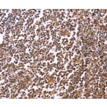 Immunohistochemistry - CRK Antibody from Signalway Antibody (36372) - Antibodies.com