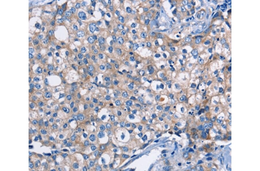 Immunohistochemistry - DMD Antibody from Signalway Antibody (36428) - Antibodies.com