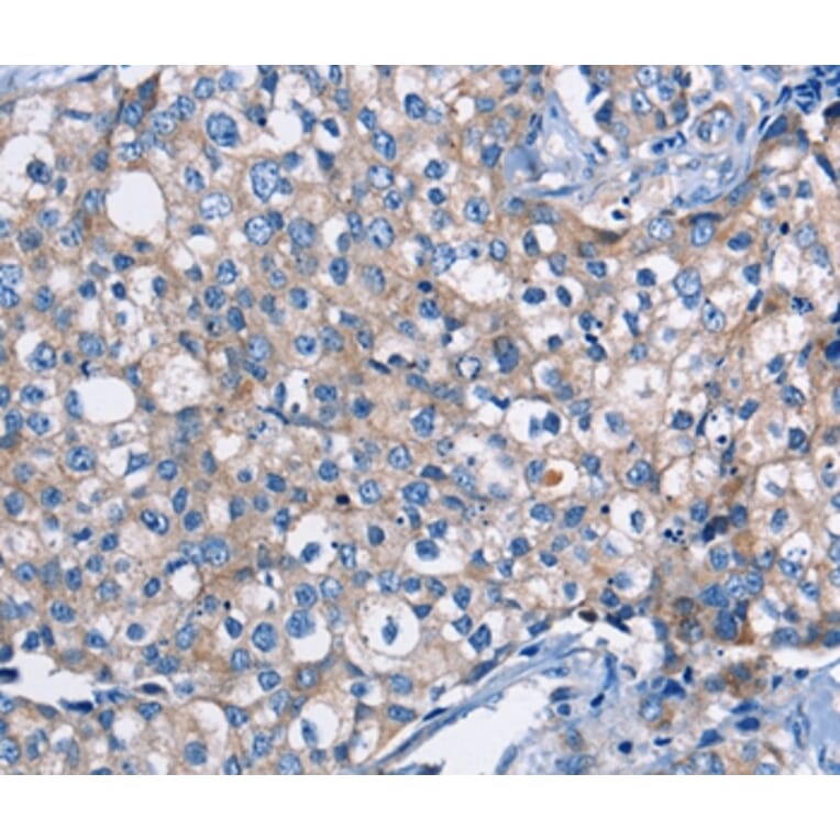 Immunohistochemistry - DMD Antibody from Signalway Antibody (36428) - Antibodies.com