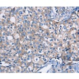 Immunohistochemistry - DMD Antibody from Signalway Antibody (36428) - Antibodies.com