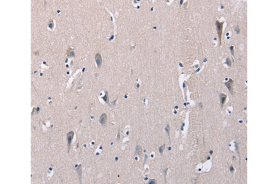 Immunohistochemistry - DMD Antibody from Signalway Antibody (36428) - Antibodies.com