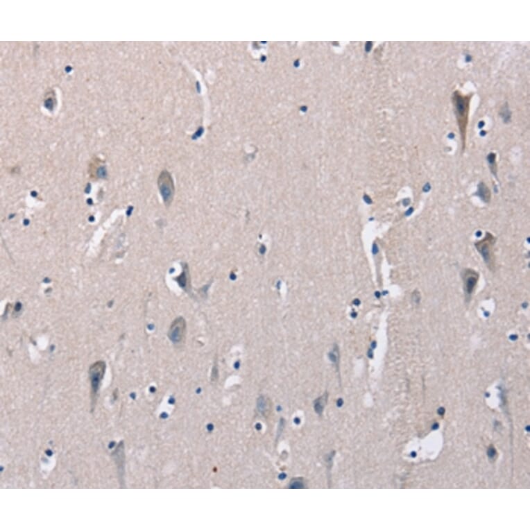 Immunohistochemistry - DMD Antibody from Signalway Antibody (36428) - Antibodies.com