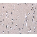 Immunohistochemistry - DMD Antibody from Signalway Antibody (36428) - Antibodies.com