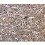 Immunohistochemistry - EDA Antibody from Signalway Antibody (36433) - Antibodies.com