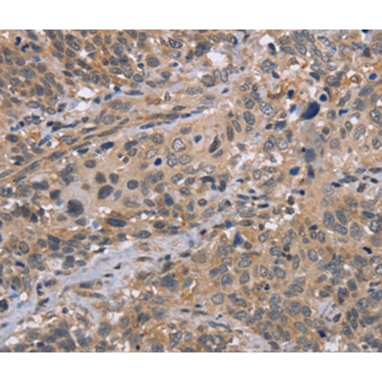 Immunohistochemistry - EDA Antibody from Signalway Antibody (36433) - Antibodies.com