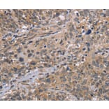 Immunohistochemistry - EDA Antibody from Signalway Antibody (36433) - Antibodies.com