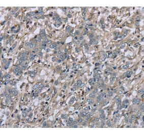 Immunohistochemistry - FAP Antibody from Signalway Antibody (36465) - Antibodies.com