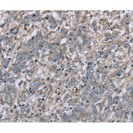 Immunohistochemistry - FAP Antibody from Signalway Antibody (36465) - Antibodies.com