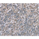 Immunohistochemistry - FAP Antibody from Signalway Antibody (36465) - Antibodies.com