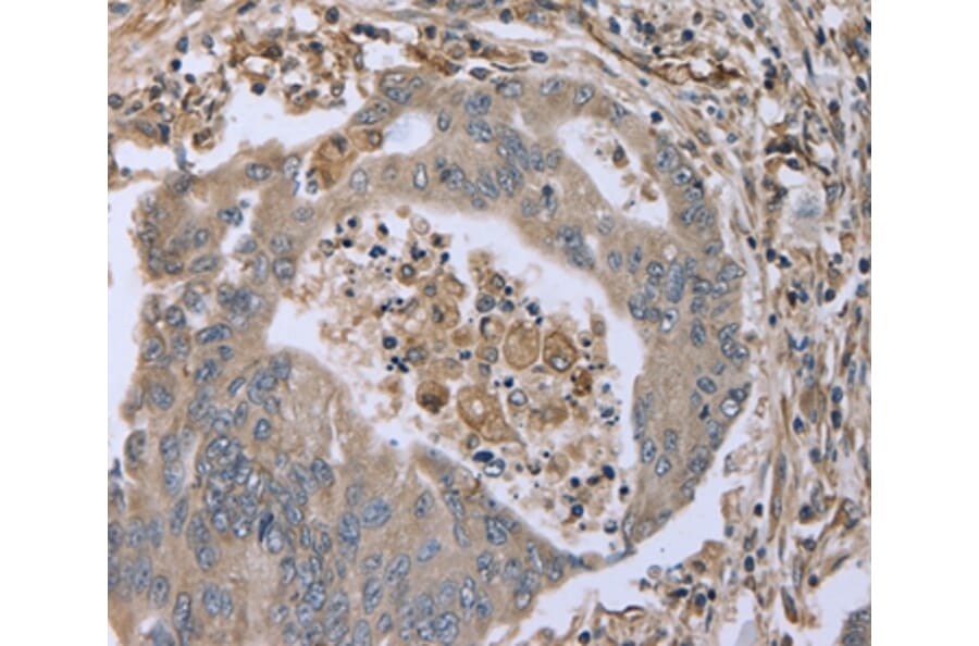 Immunohistochemistry - FAP Antibody from Signalway Antibody (36465) - Antibodies.com