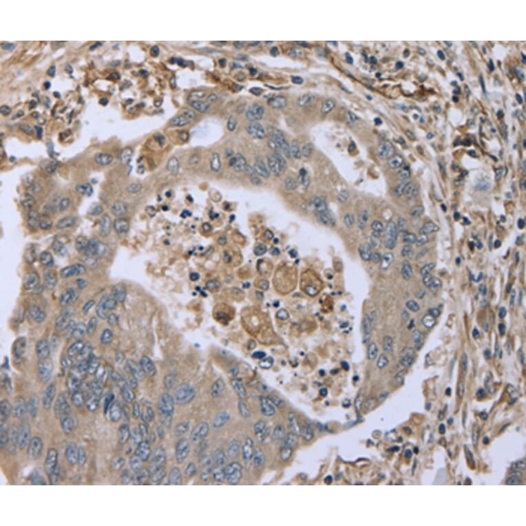Immunohistochemistry - FAP Antibody from Signalway Antibody (36465) - Antibodies.com