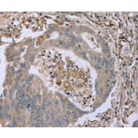 Immunohistochemistry - FAP Antibody from Signalway Antibody (36465) - Antibodies.com