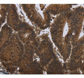 Immunohistochemistry - PIP Antibody from Signalway Antibody (36498) - Antibodies.com