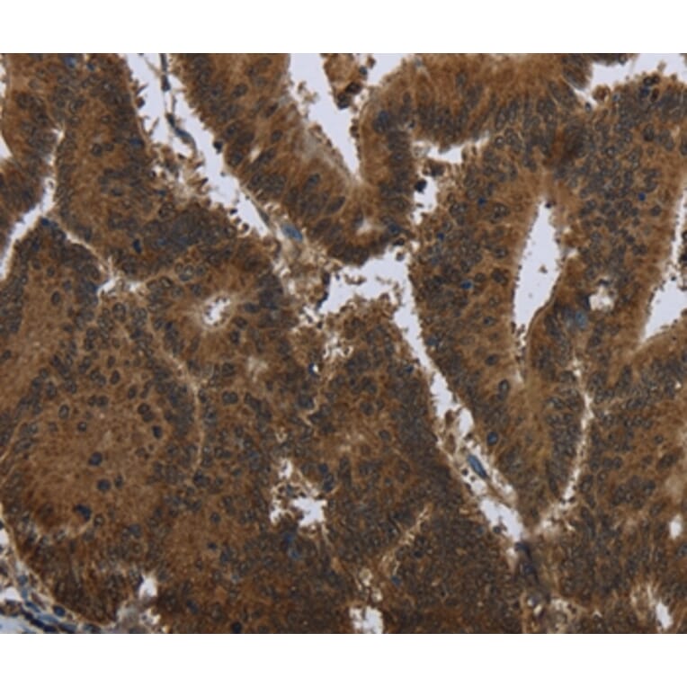Immunohistochemistry - PIP Antibody from Signalway Antibody (36498) - Antibodies.com
