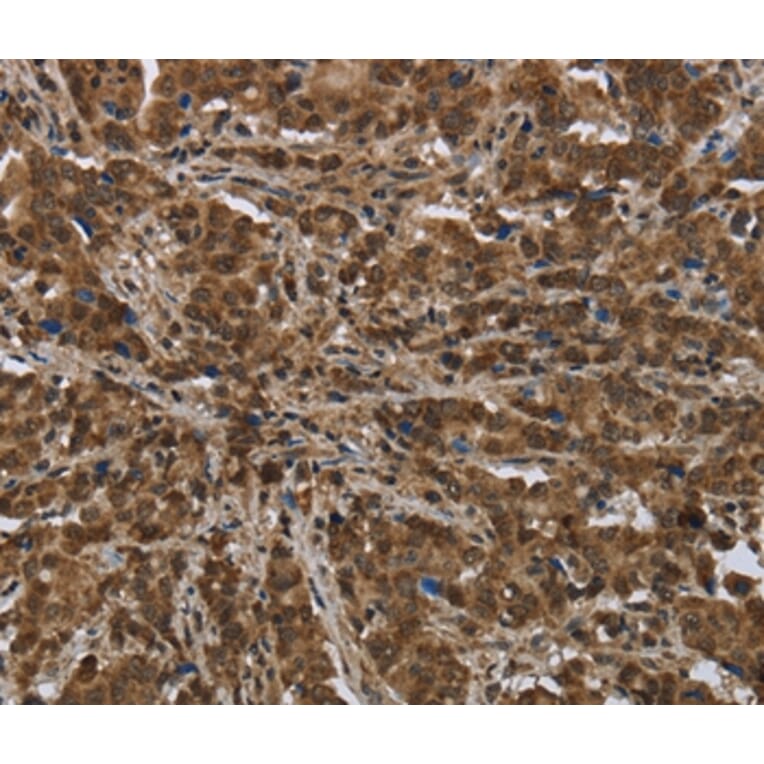 Immunohistochemistry - PIP Antibody from Signalway Antibody (36498) - Antibodies.com