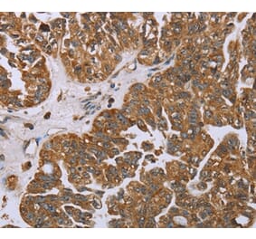 Immunohistochemistry - NOV Antibody from Signalway Antibody (36547) - Antibodies.com