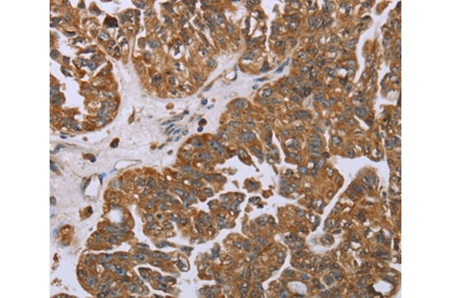 Immunohistochemistry - NOV Antibody from Signalway Antibody (36547) - Antibodies.com