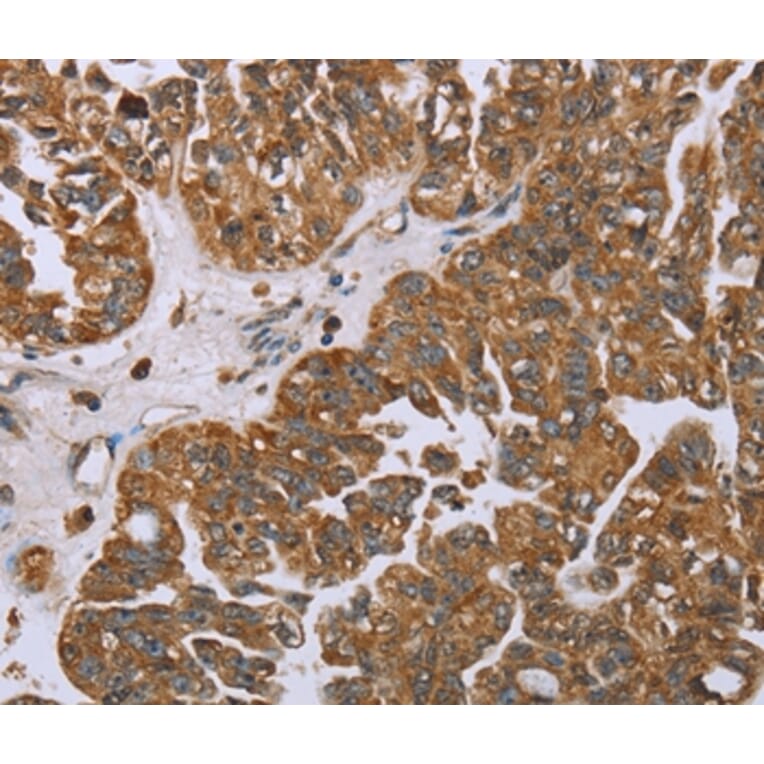 Immunohistochemistry - NOV Antibody from Signalway Antibody (36547) - Antibodies.com