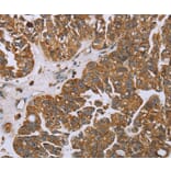 Immunohistochemistry - NOV Antibody from Signalway Antibody (36547) - Antibodies.com