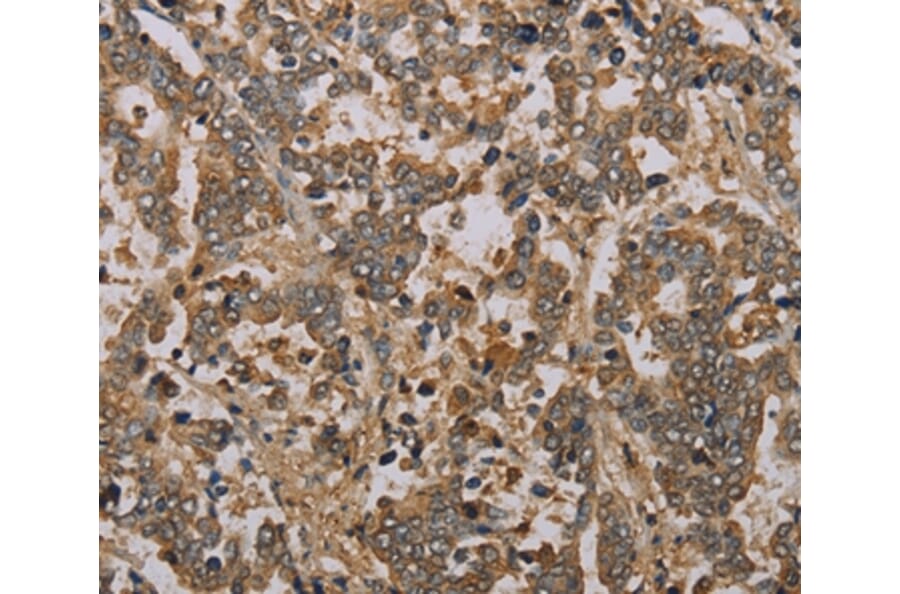 Immunohistochemistry - NOV Antibody from Signalway Antibody (36547) - Antibodies.com