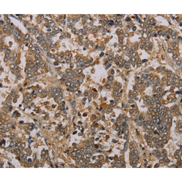 Immunohistochemistry - NOV Antibody from Signalway Antibody (36547) - Antibodies.com