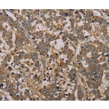 Immunohistochemistry - NOV Antibody from Signalway Antibody (36547) - Antibodies.com