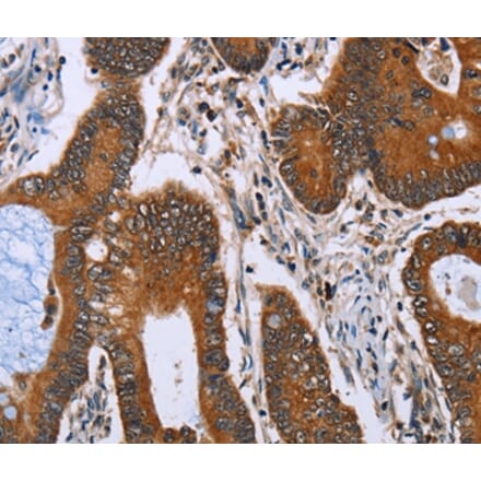 Immunohistochemistry - IHH Antibody from Signalway Antibody (36549) - Antibodies.com