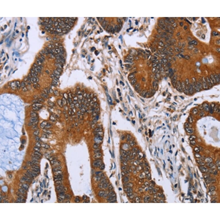 Immunohistochemistry - IHH Antibody from Signalway Antibody (36549) - Antibodies.com