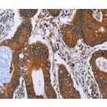 Immunohistochemistry - IHH Antibody from Signalway Antibody (36549) - Antibodies.com