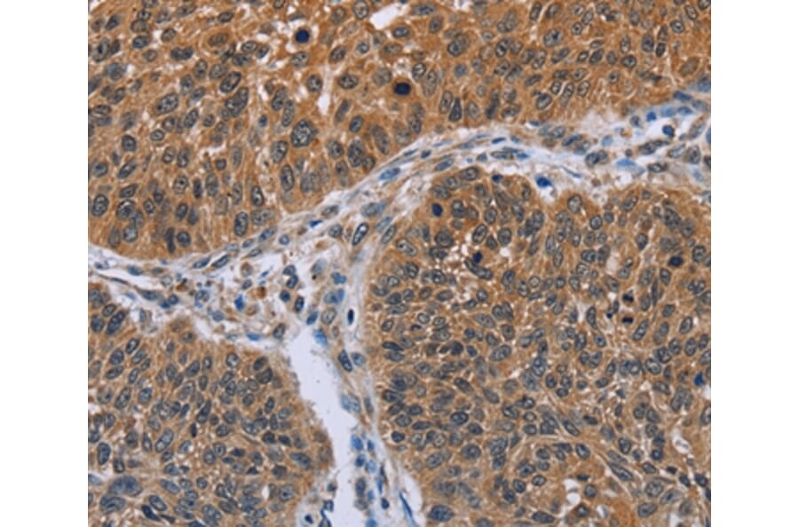 Immunohistochemistry - IHH Antibody from Signalway Antibody (36549) - Antibodies.com