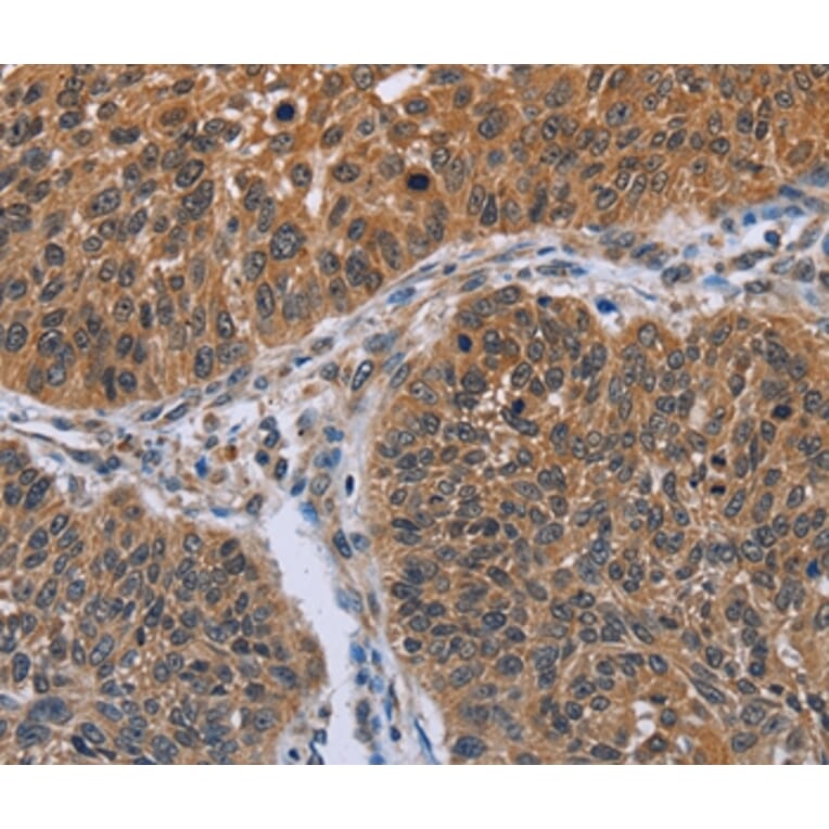 Immunohistochemistry - IHH Antibody from Signalway Antibody (36549) - Antibodies.com