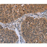 Immunohistochemistry - IHH Antibody from Signalway Antibody (36549) - Antibodies.com