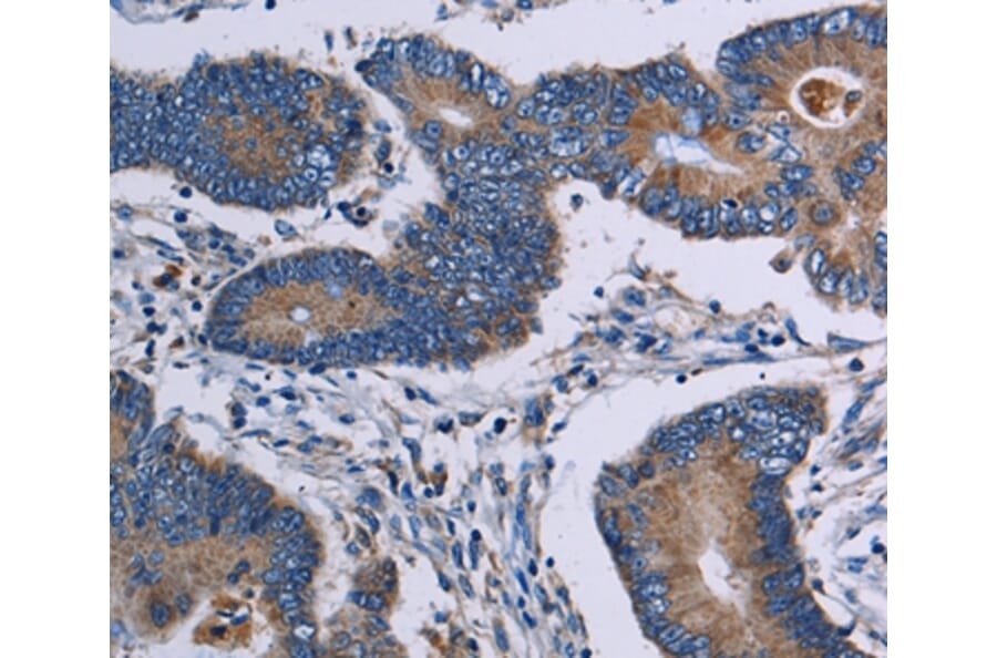 Immunohistochemistry - ITK Antibody from Signalway Antibody (36559) - Antibodies.com