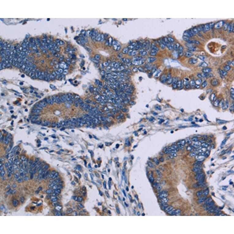 Immunohistochemistry - ITK Antibody from Signalway Antibody (36559) - Antibodies.com