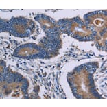 Immunohistochemistry - ITK Antibody from Signalway Antibody (36559) - Antibodies.com