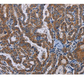 Immunohistochemistry - LYN Antibody from Signalway Antibody (36592) - Antibodies.com