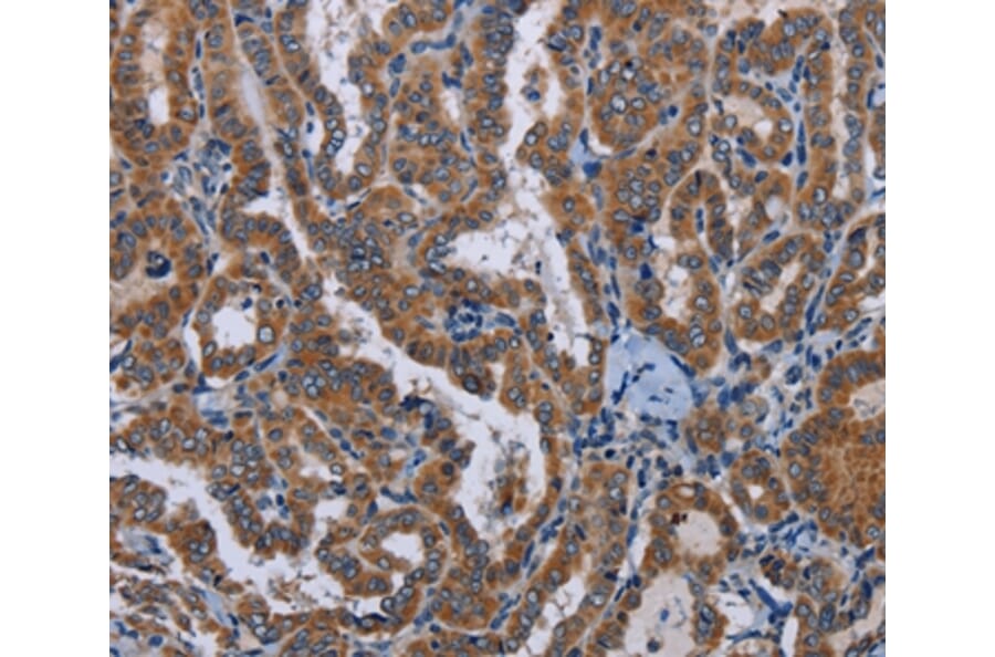 Immunohistochemistry - LYN Antibody from Signalway Antibody (36592) - Antibodies.com