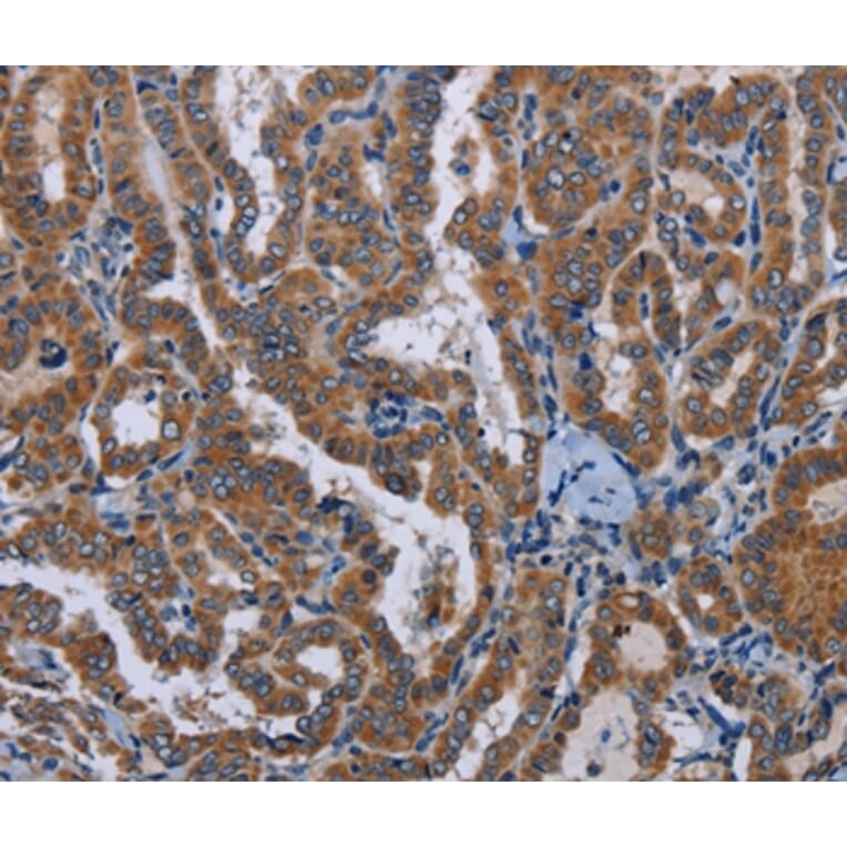 Immunohistochemistry - LYN Antibody from Signalway Antibody (36592) - Antibodies.com