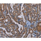 Immunohistochemistry - LYN Antibody from Signalway Antibody (36592) - Antibodies.com